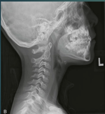 <p>projection, anatomy</p>