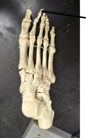 <p>Name Tarsal Bone</p>