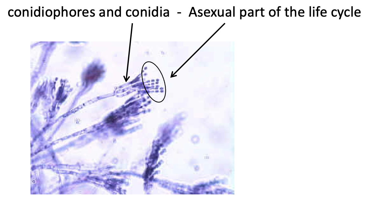 <p>A type of ascomycota</p><p>The hand structures are <strong>conidophores</strong>, and the small dots on the ends are <strong>conidia</strong>, which are asexually reproduced </p>