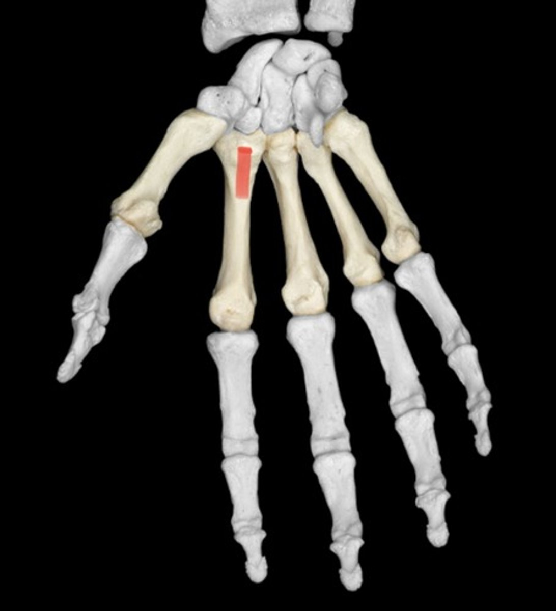 <p>What bones are highlighted?</p>