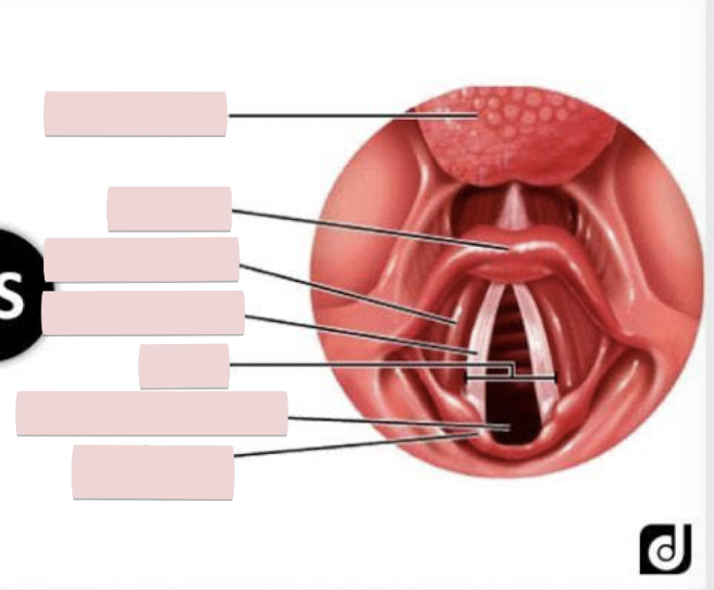 <p>Label the figure</p>