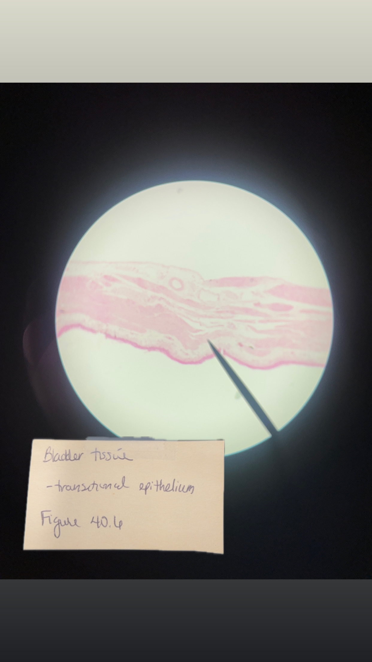 <p>BLADDER TISSUE </p>