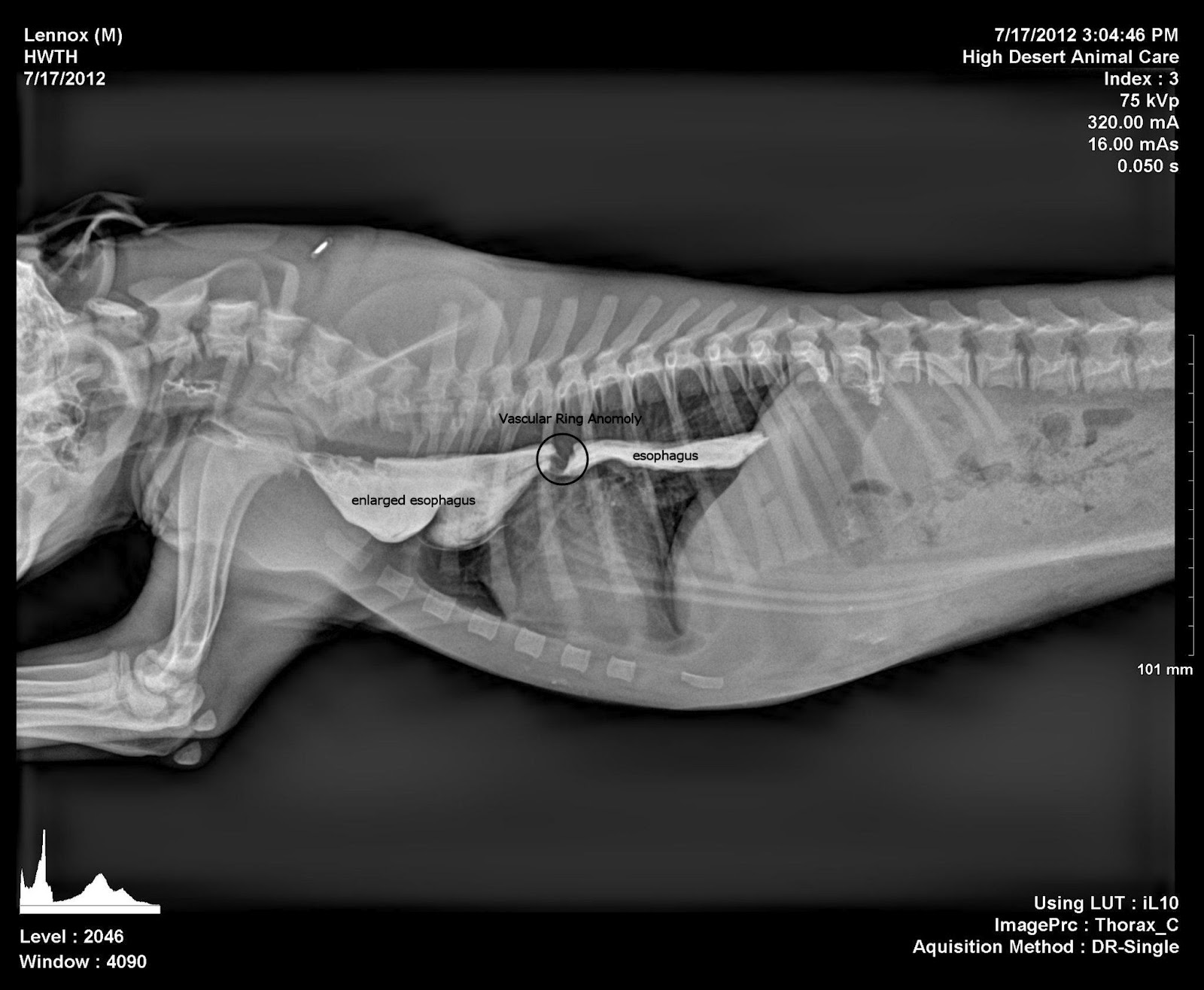 <p>Positive contrast esophagram</p>