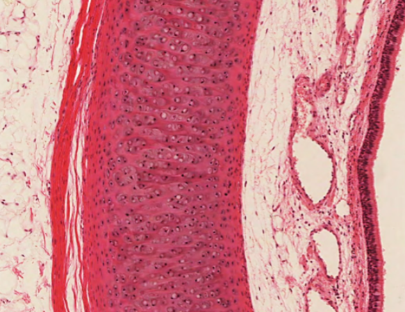 <p>ID the stained redish pink structure</p>