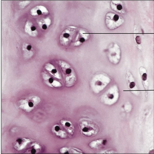 <p>What type of cartilage?</p>