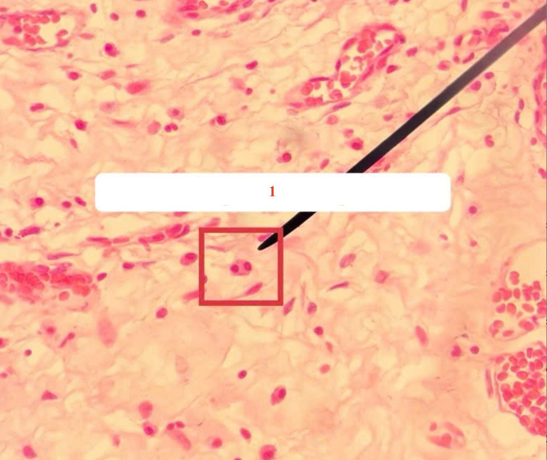 <p>Tế bào gì ?</p>