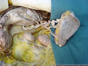 <p>what side of the organ to the right of the image is currently anterior?</p>
