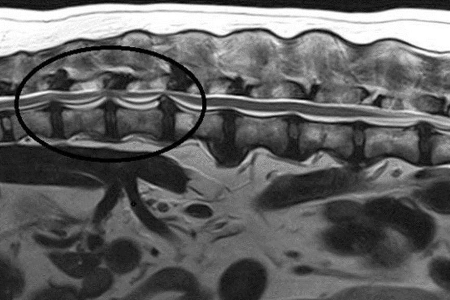 <p>X-rays, CT/MRI, and myelography.</p>
