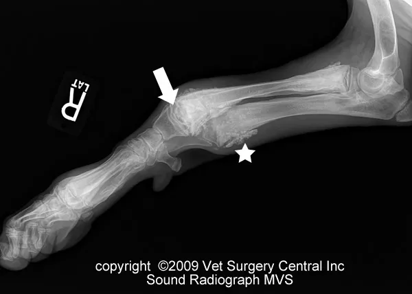 <p>Hypertrophic osteodystrophy (HOD)</p>