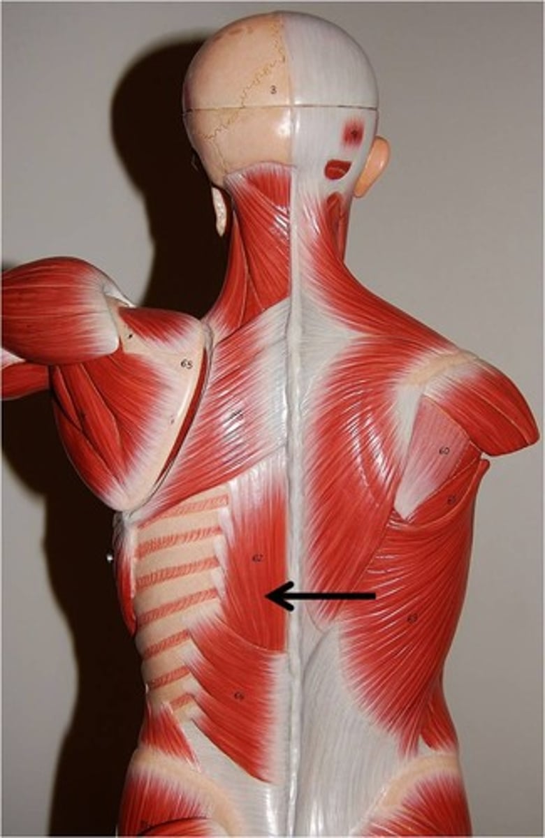 <p>Extends and laterally flexes vertebral column</p>