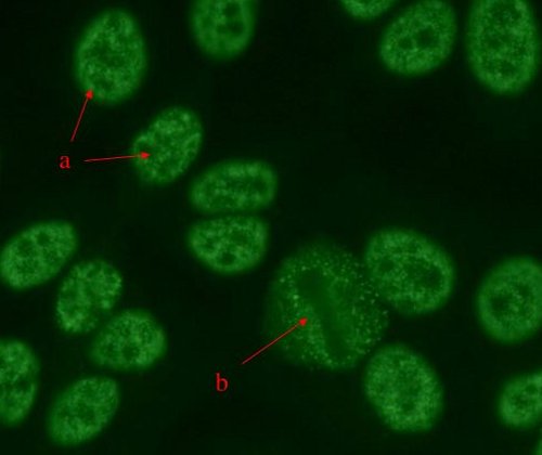 <p>This ANA pattern is characterized by granular staining in the nuclei of the interphase cells (a). There is also an absence of staining in the chromosomal area of the metaphase mitotic cells (b). Which pattern is this?</p>