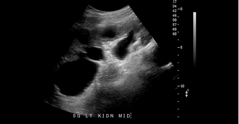 term image