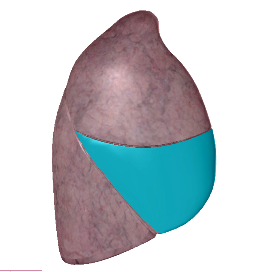 <p>top most lobe</p>