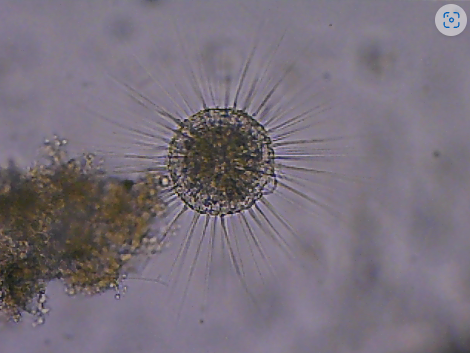 <p>they have thin pseudopods supported by microtubules, mainly amoeboid (sun shaped)</p>