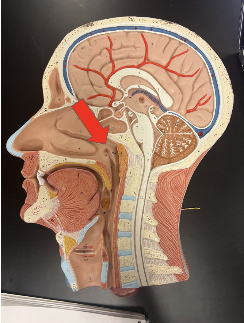 <p>This structure is the</p>