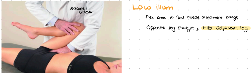 <p><span style="background-color: transparent;">F</span></p><ol><li><p><span style="background-color: transparent;">Use iliac crest to find ASIS, then move to AIIS.</span></p></li><li><p><span style="background-color: transparent;">Follow from AIIS down inguinal ligament until you feel a bulb OR feel pubic tubercle and go ½ in lateral and ½ in superior</span></p></li><li><p><span style="background-color: transparent;">Physician stands on the same side of the tender point</span></p></li><li><p><span style="background-color: transparent;">Markedly flex patient’s hip </span></p></li><li><p><span style="background-color: transparent;">Fine tune with more/less hip flexion</span></p></li></ol><p></p>