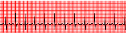 <p>what waveform is this</p>