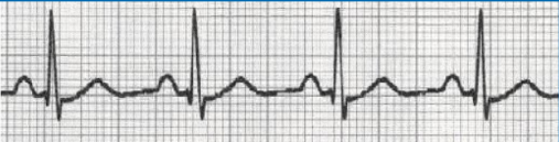 <p>what waveform is this </p>