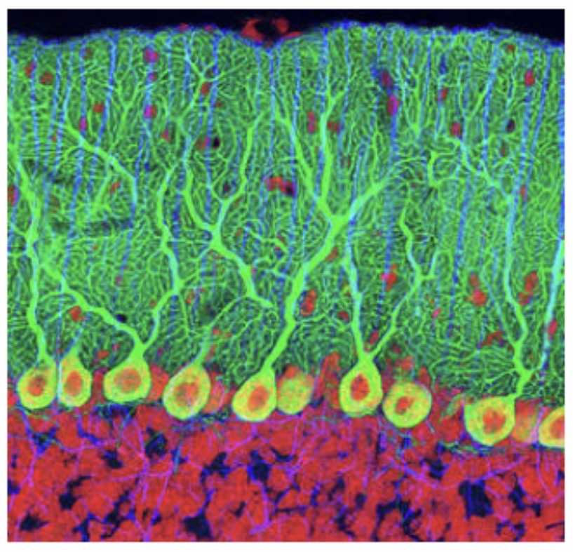 <p>Purkinje Neuron : Function : Coordinates movement and balance by transmitting impulses in the cerebellum.</p>