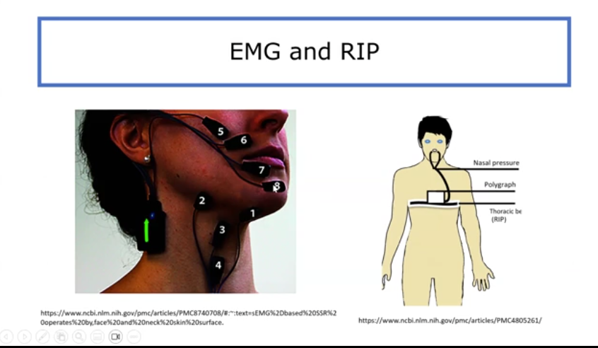 <p>measures motor unit action potentials</p><p>electrical sensors</p><p>its surface. Includes needle and hooked-wire electrodes</p><p>provides patient feedback during therapy</p>