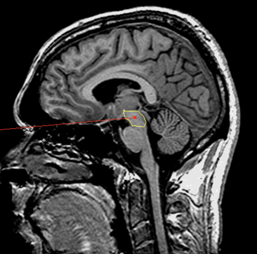 <p>What is the area highlighted called?</p>
