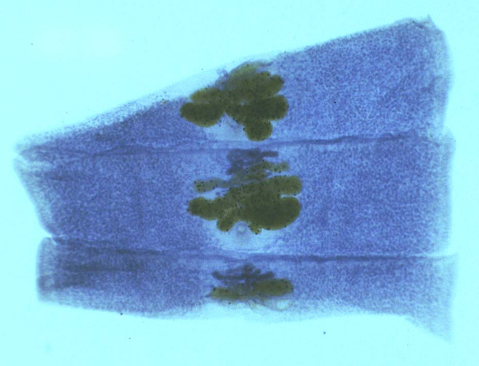 <p>Width > length compared to Taenia</p>