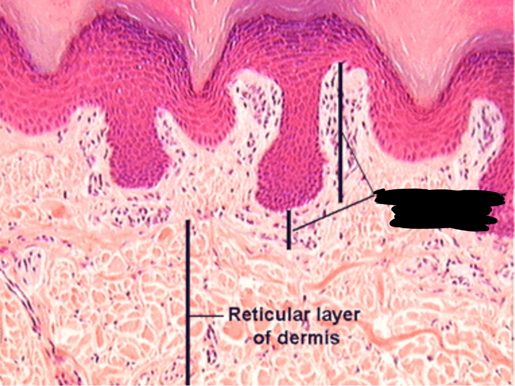 term image