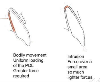 <ul><li><p>Bodily and intrusion forces</p></li><li><p>the more pdl surface involved the more force required to generate the desired tooth movement</p></li></ul><p></p>