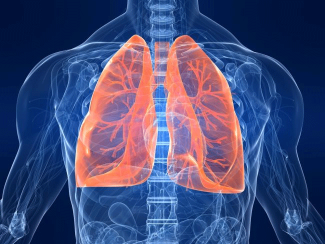 <p>Greg came into the clinic with a severe cough and a high fever. The doctor explained to Greg that he was fortunate the <strong><em>inflammation of the lungs </em></strong>only affected one side. </p>