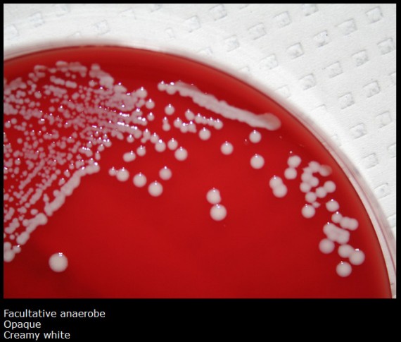 <ul><li><p>contaminant unless found in urine</p><ul><li><p>causes <strong>UTIs </strong>(cystitis, pyelonephritis, catheter-associated UTIs)</p></li><li><p>can induce UTIs with <u>low colony counts</u></p></li></ul></li><li><p><strong>lab ID</strong></p><ul><li><p>coagulase negative</p></li><li><p>DNase negative</p></li><li><p>resistant to novobiocin</p></li><li><p>grows on MSA with variable fermentation</p></li></ul></li></ul><p></p>