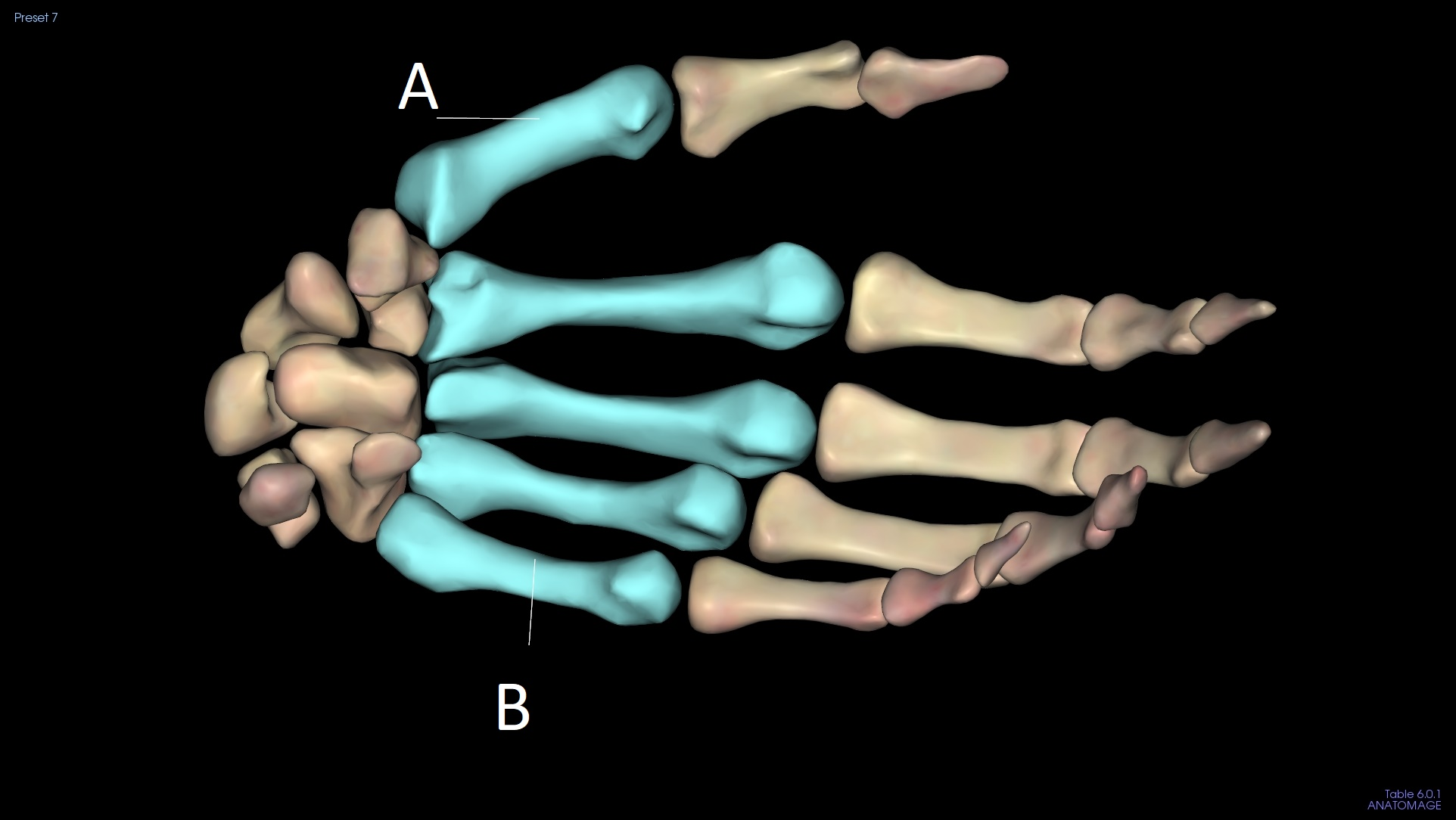 <p>A</p>