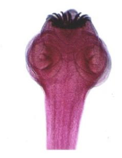 <ul><li><p>causes Taeniasis<span> (intestinal pork tapeworm infection)</span></p></li></ul><p></p>