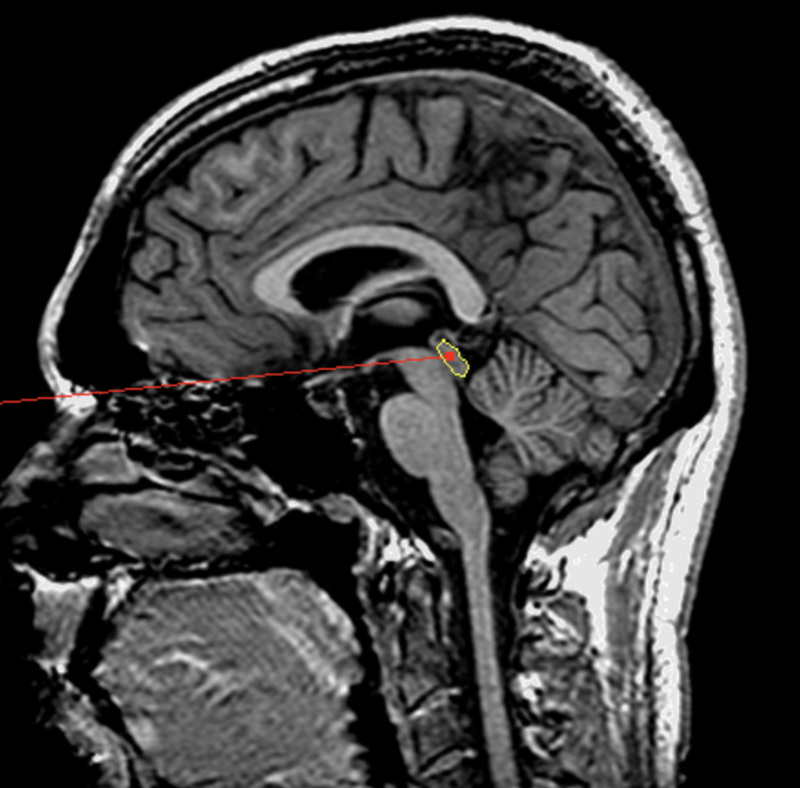 <p>What is the area highlighted called?</p>