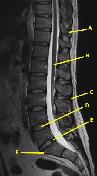 <p>What is letter E ?</p>