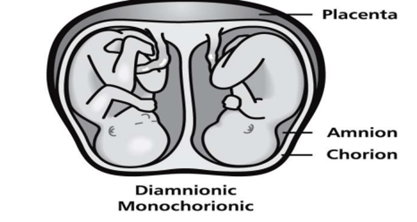 <p>1 placenta/ 2 amnios/ 1 chorion; concern for twin-twin transfusion syndrome (TTTS)</p>