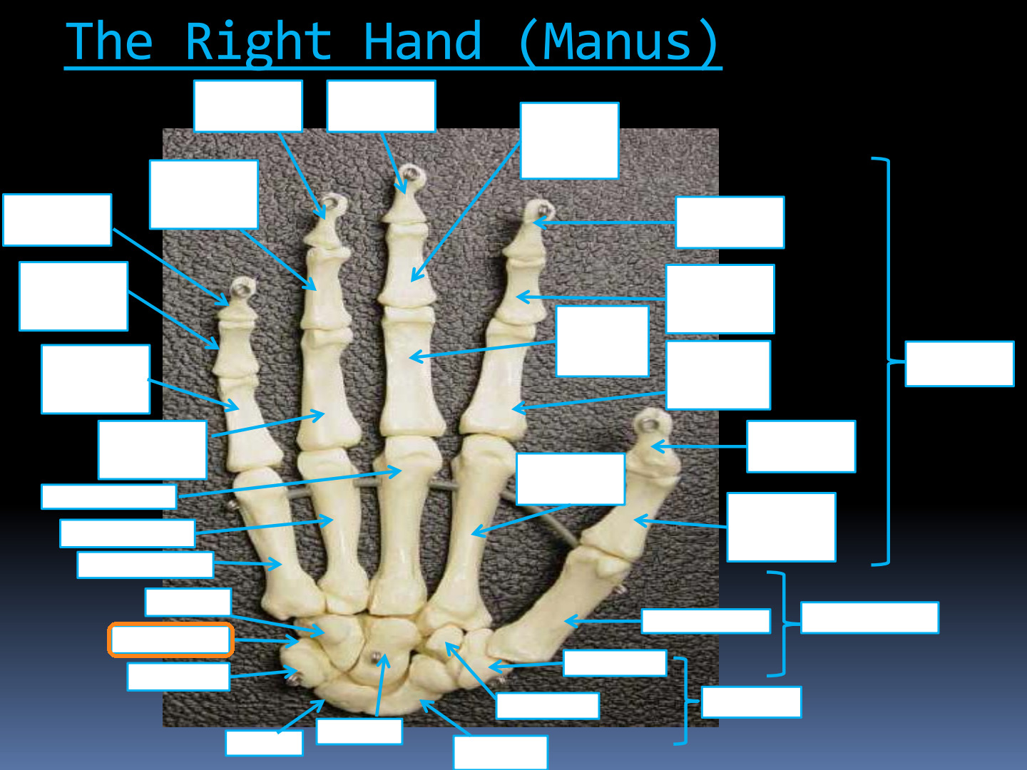 <p>Identify the highlighted structure in the Right Hand (Manus): Carpals diagram.</p>