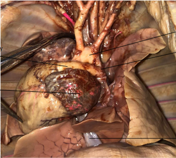 <p>What vessel is present in fetal animals but not in adult babies? Why?</p>