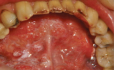 <p>what is this condition</p>