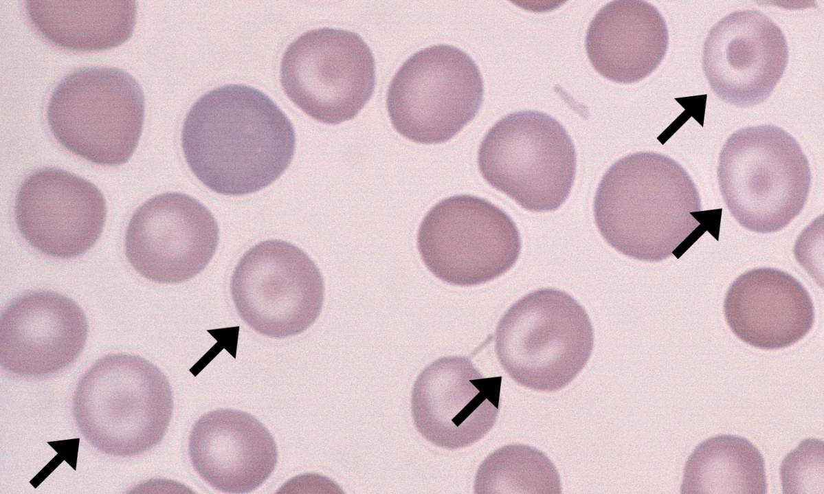 <p>Codocyte (Target cell)</p>