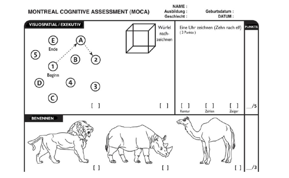 <p>MOCA (Montreal cognitive Assesment) </p>