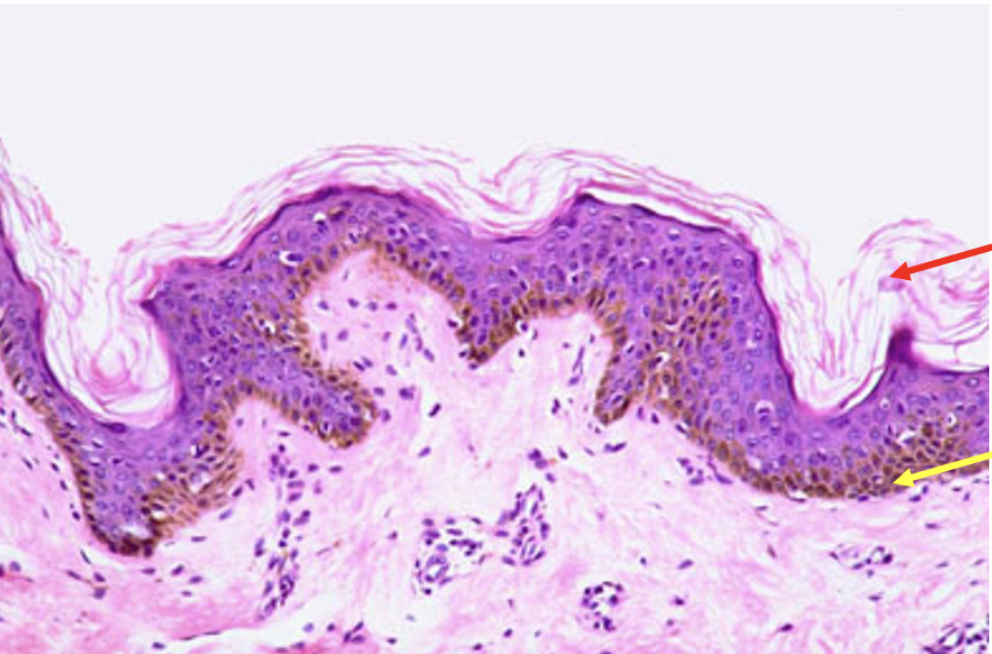 <p>Identify the epithelial layer at the tip of the red arrow</p>