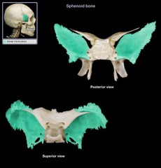 <p>disarticulated</p>