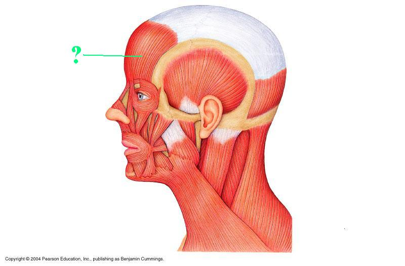 <p>Identify the indicated muscle</p>