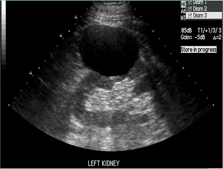 <p>What pathology is shown here </p>