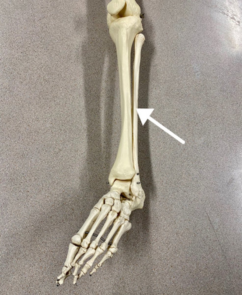 <p>What is this bone?</p>
