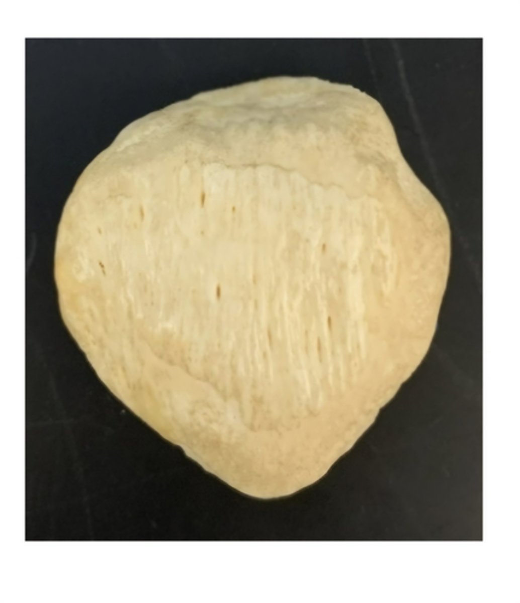 <p>bone?</p>