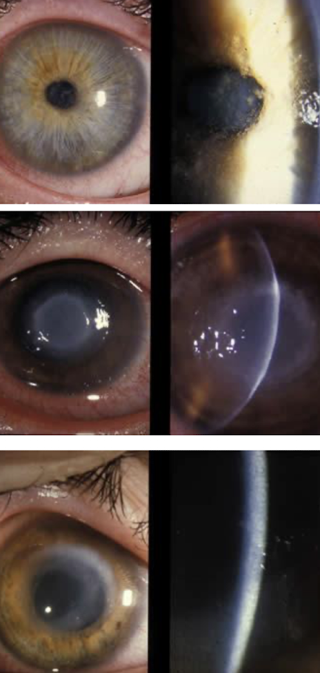 <p>What condition is this?</p>
