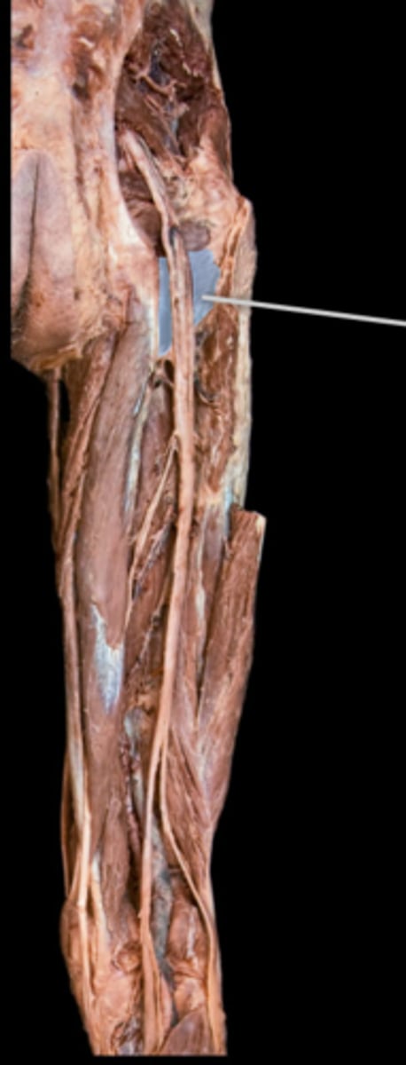 <p>What muscle is this?</p>