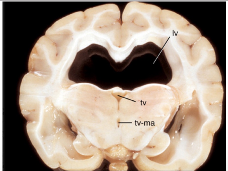 <p>Name lesion + supporting observations</p>