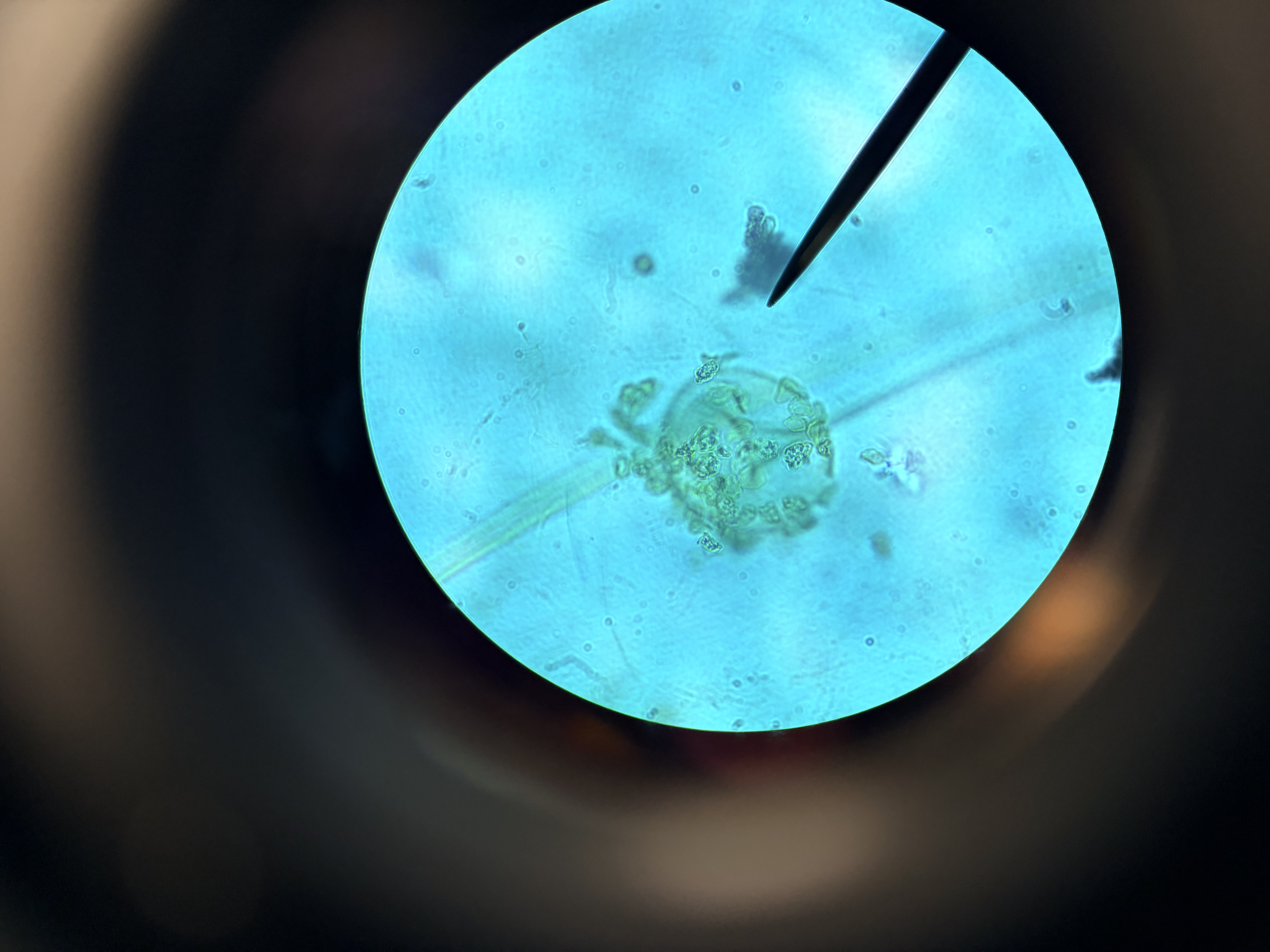 <p>*What fungi is this</p>